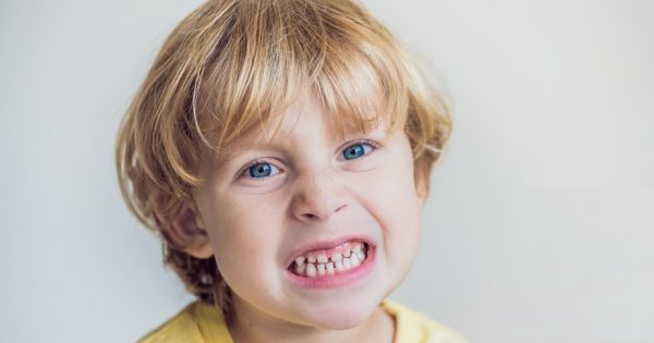 Le bruxisme chez l’enfant : de quoi s’agit-il et comment y remédier ? Le bruxisme chez l'enfant : de quoi s'agit-il et comment y remédier ?