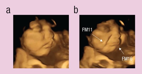 Bébés et goûts : les réactions du fœtus déjà dans le ventre Bébés et goûts : les réactions du fœtus déjà dans le ventre