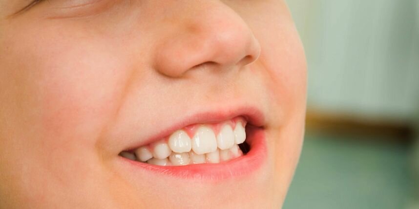 Comment s’assurer que les dents de votre enfant sont en bonne santé ? Comment s’assurer que les dents de votre enfant sont en bonne santé ?