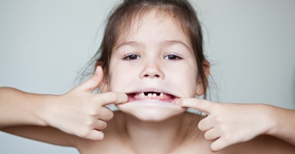 Les dents de lait sont-elles une source de cellules souches ? L'avis des experts