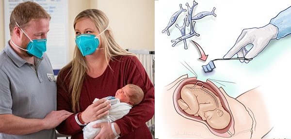 spina-bifida-intervento-in-utero-con-cerotto-salva-3-neonati