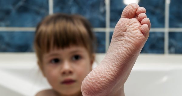 Doigts fripés et vraies raisons de sortir les enfants de l'eau