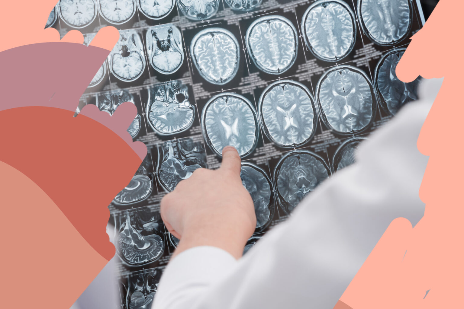 adult pointing at brain imaging