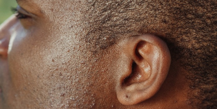 An image of a person's ear