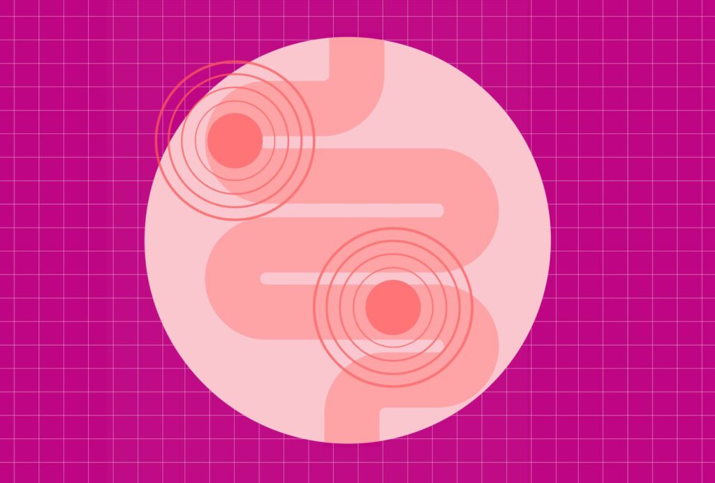 Devriez-vous suivre un régime pauvre en histamine ? Voici l’avis d’un gastro-entérologue Devriez-vous suivre un régime pauvre en histamine ? Voici l'avis d'un gastro-entérologue