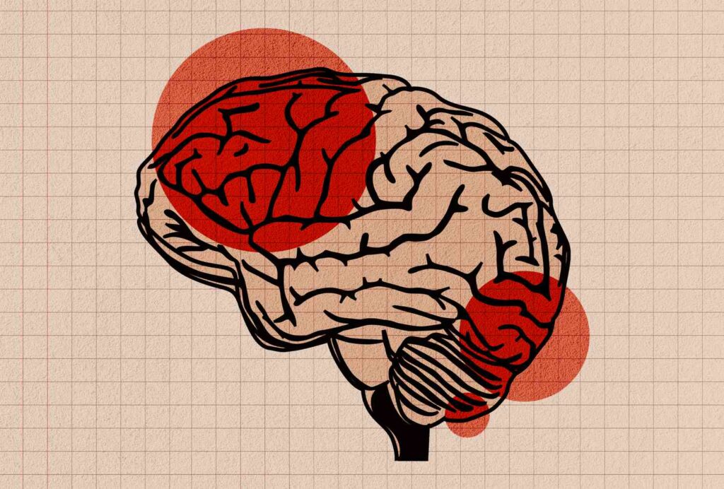 Une étude révèle qu'un diagnostic précoce du diabète peut augmenter le risque de démence