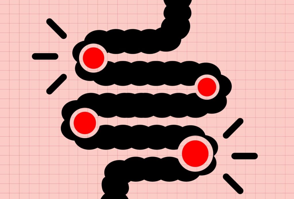 Les aliments acides peuvent augmenter votre risque de cancer