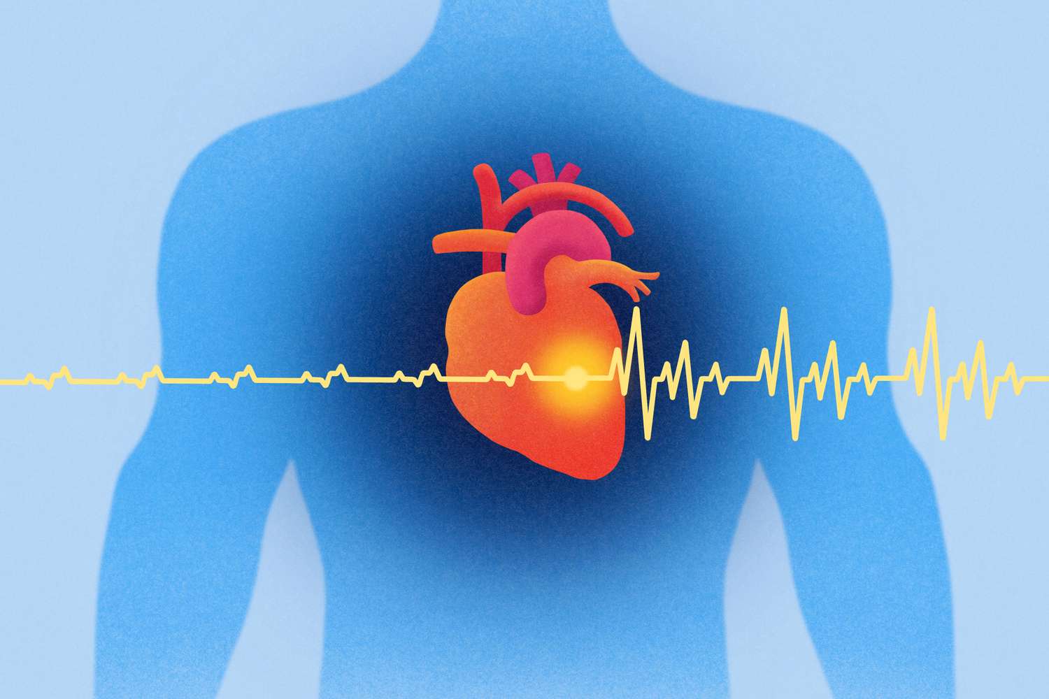 Cette habitude peut augmenter le risque de maladie cardiaque chez les ...