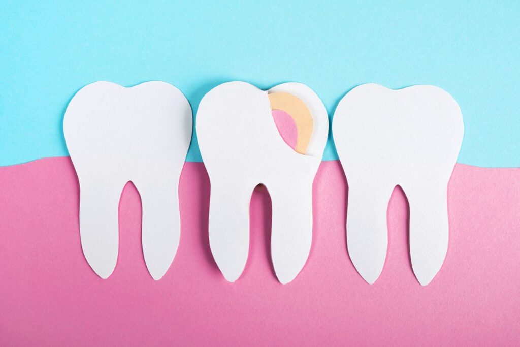 Trop de viande rouge peut aggraver la santé des gencives